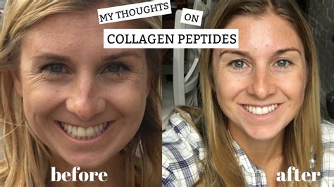 Collagen Peptides Side Effects A Technical Guide on Purity Specifications and Manufacturing Sourcing